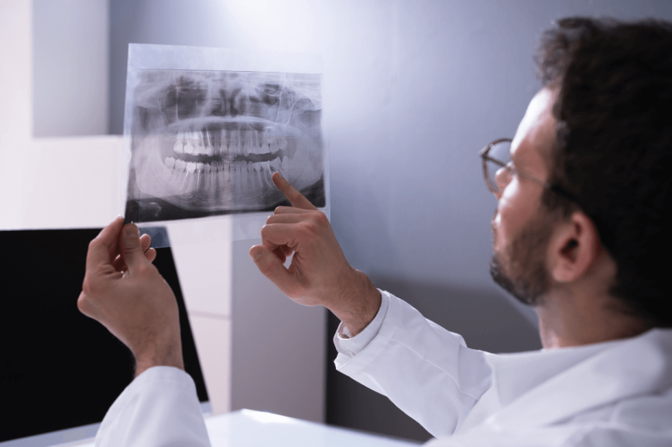Benefits of Keeping Wisdom Teeth: An In-depth Analysis