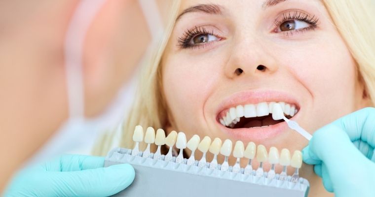 Woman smiling, dental professional holding up shades of teeth whitening to her smile. 